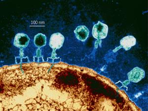 噬菌体侵染细菌的电镜照片