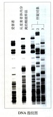 DNA指纹图