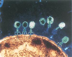 噬菌体浸染细菌的电镜照片