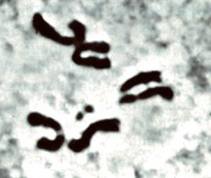 果蝇的染色体照片